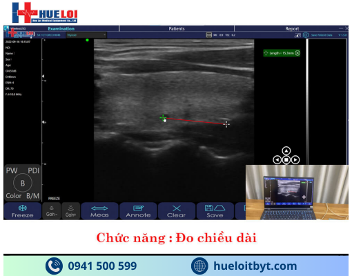 MÁY SIÊU ÂM CẦM TAY KHÔNG DÂY 3 ĐẦU DÒ