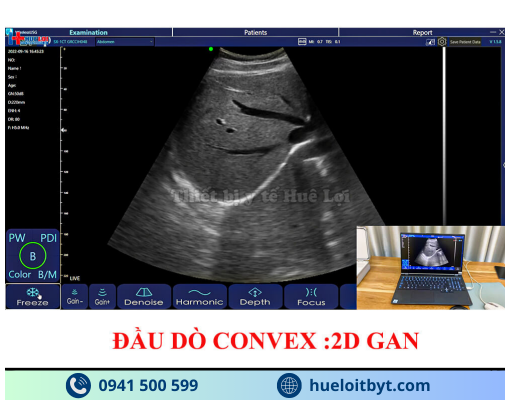 MÁY SIÊU ÂM CẦM TAY KHÔNG DÂY 3 ĐẦU DÒ