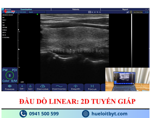 MÁY SIÊU ÂM CẦM TAY KHÔNG DÂY 3 ĐẦU DÒ