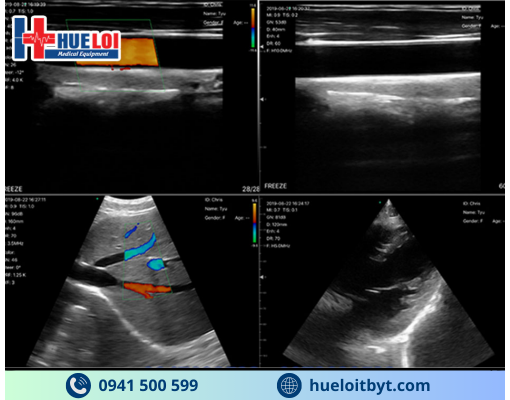 MÁY SIÊU ÂM CẦM TAY KHÔNG DÂY 3 ĐẦU DÒ