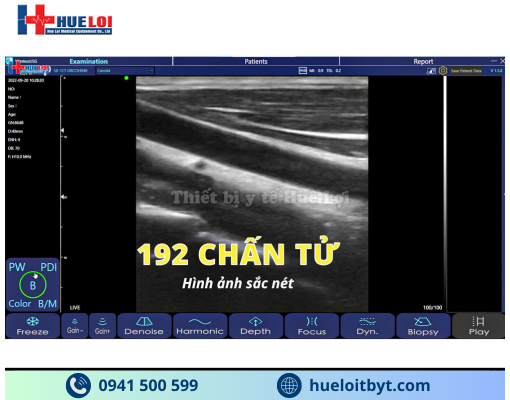 MÁY SIÊU ÂM CẦM TAY KHÔNG DÂY 3 ĐẦU DÒ