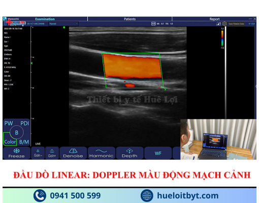 MÁY SIÊU ÂM CẦM TAY KHÔNG DÂY 3 ĐẦU DÒ