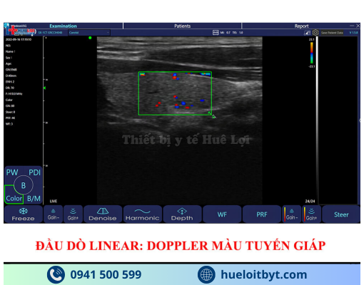 MÁY SIÊU ÂM CẦM TAY KHÔNG DÂY 3 ĐẦU DÒ