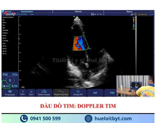 MÁY SIÊU ÂM CẦM TAY KHÔNG DÂY 3 ĐẦU DÒ