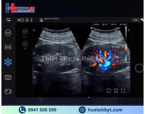 MÁY SIÊU ÂM CẦM TAY EDAN NANO C5 EXP HIỆN ĐẠI