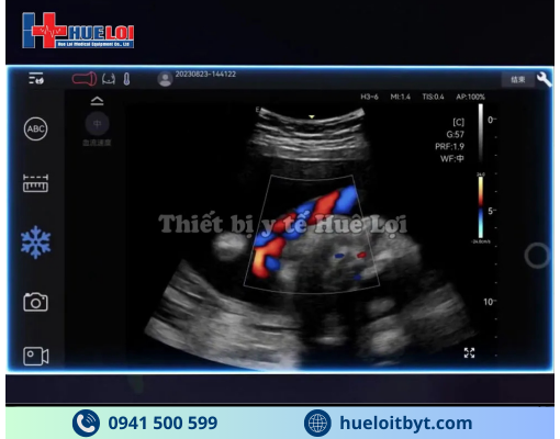 MÁY SIÊU ÂM CẦM TAY EDAN NANO C5 EXP HIỆN ĐẠI