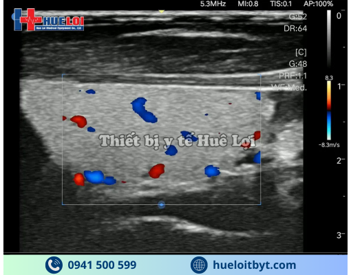 MÁY SIÊU ÂM CẦM TAY EDAN NANO L12 EXP VỚI CÁC CÔNG NGHỆ HIỆN ĐẠI