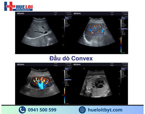 MÁY SIÊU ÂM HÌNH ẢNH EDAN AX3 CAO CẤP