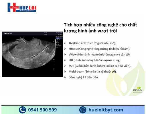 MÁY SIÊU ÂM HÌNH ẢNH EDAN AX3 CAO CẤP