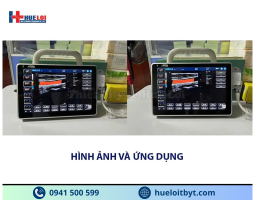 MÁY SIÊU ÂM XÁCH TAY CẢM ỨNG 2 ĐẦU DÒ P10