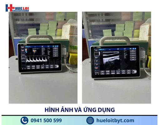 MÁY SIÊU ÂM XÁCH TAY CẢM ỨNG 2 ĐẦU DÒ P10