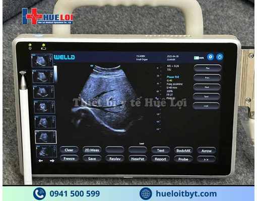 MÁY SIÊU ÂM XÁCH TAY CẢM ỨNG 2 ĐẦU DÒ P10