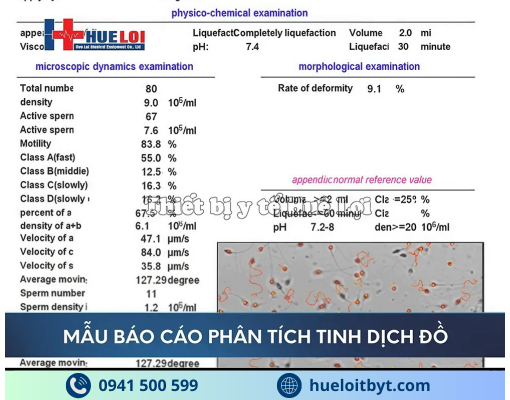 MÁY PHÂN TÍCH TINH DỊCH ĐỒ CHÍNH HÃNG