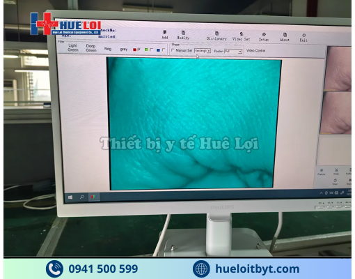 MÁY SOI CỔ TỬ CUNG GIÁ RẺ SW-302