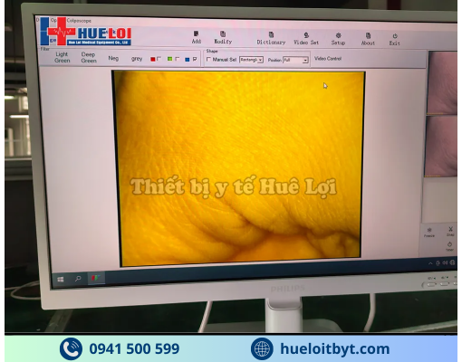 MÁY SOI CỔ TỬ CUNG FULL HD SW-304 GIÁ RẺ