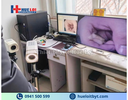 MÁY SOI CỔ TỬ CUNG FULL HD SW-304 GIÁ RẺ