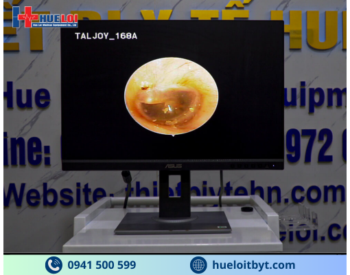 MÁY NỘI SOI TAI MŨI HỌNG SD TJ-168A GIÁ RẺ