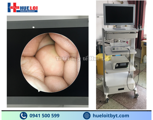 MÁY NỘI SOI TAI MŨI HỌNG SD TJ-168A GIÁ RẺ