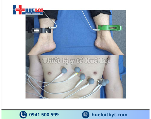 MÁY ĐO ĐIỆN TIM 3 KÊNH ECG300G