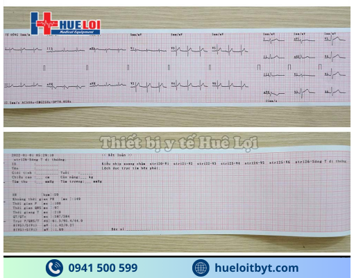 MÁY ĐO ĐIỆN TIM 3 KÊNH ECG300G