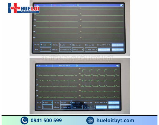MÁY ĐIỆN TIM 6 KÊNH ECG600G