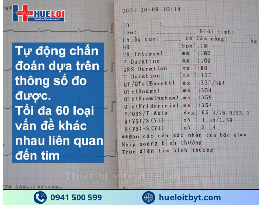 MÁY ĐIỆN TIM 6 KÊNH ECG600G