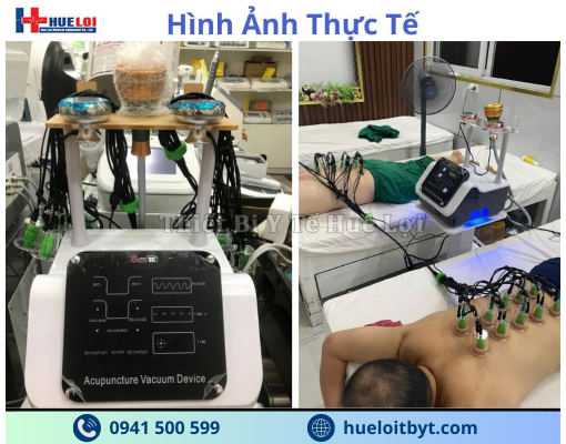 MÁY ĐIỆN CHÂM KHÔNG KIM GIÁC HÚT ĐA NĂNG