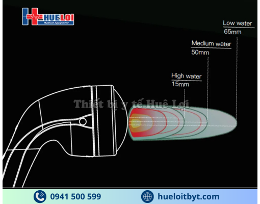 MÁY XUNG KÍCH HỘI TỤ CAO CẤP EMFOCUS-I