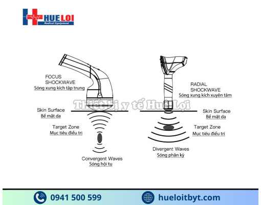 MÁY XUNG KÍCH HỘI TỤ CAO CẤP EMFOCUS-I