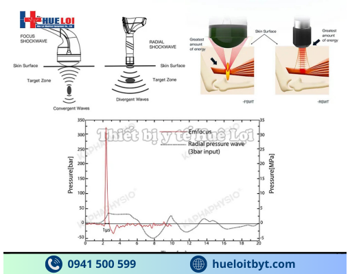 MÁY TRỊ LIỆU BẰNG SÓNG XUNG KÍCH HỘI TỤ CAO CẤP EMFOCUS-III