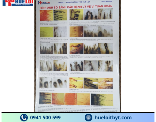 KÍNH HIỂN VI SOI MẠCH MÁU GIÁ RẺ