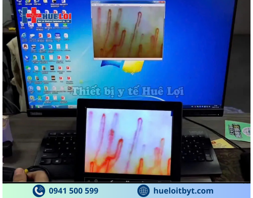 KÍNH HIỂN VI SOI MẠCH MÁU ĐỘ PHÓNG ĐẠI CAO