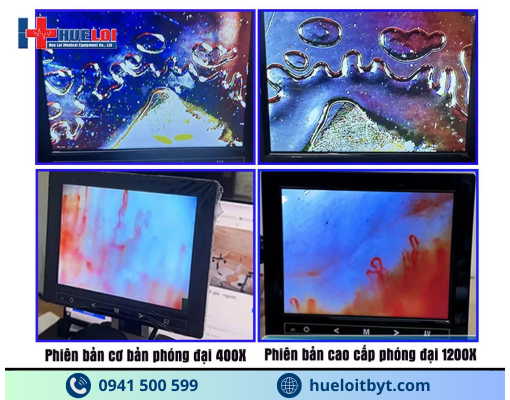 KÍNH HIỂN VI SOI MẠCH MÁU ĐỘ PHÓNG ĐẠI CAO